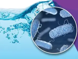Basel Legionella Outbreak Reaches 28 Cases As Prosecutors Open Negligent-Homicide Probe